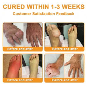 ZVLZVL® Bee Venom Pain-Relief Bone Healing Cream 20 ZVLZVL® Bee Venom Pain-Relief Bone Healing Cream