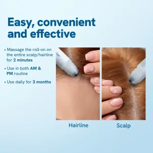 Hair Growth Roll-On Serum – See hair growth in 4 weeks 14 Hair Growth Roll-On Serum – See hair growth in 4 weeks