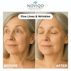 Noviqo™ – Anti-Wrinkle Freeze-Dried Nano-Silk Collagen System 12 Noviqo™ – Anti-Wrinkle Freeze-Dried Nano-Silk Collagen System