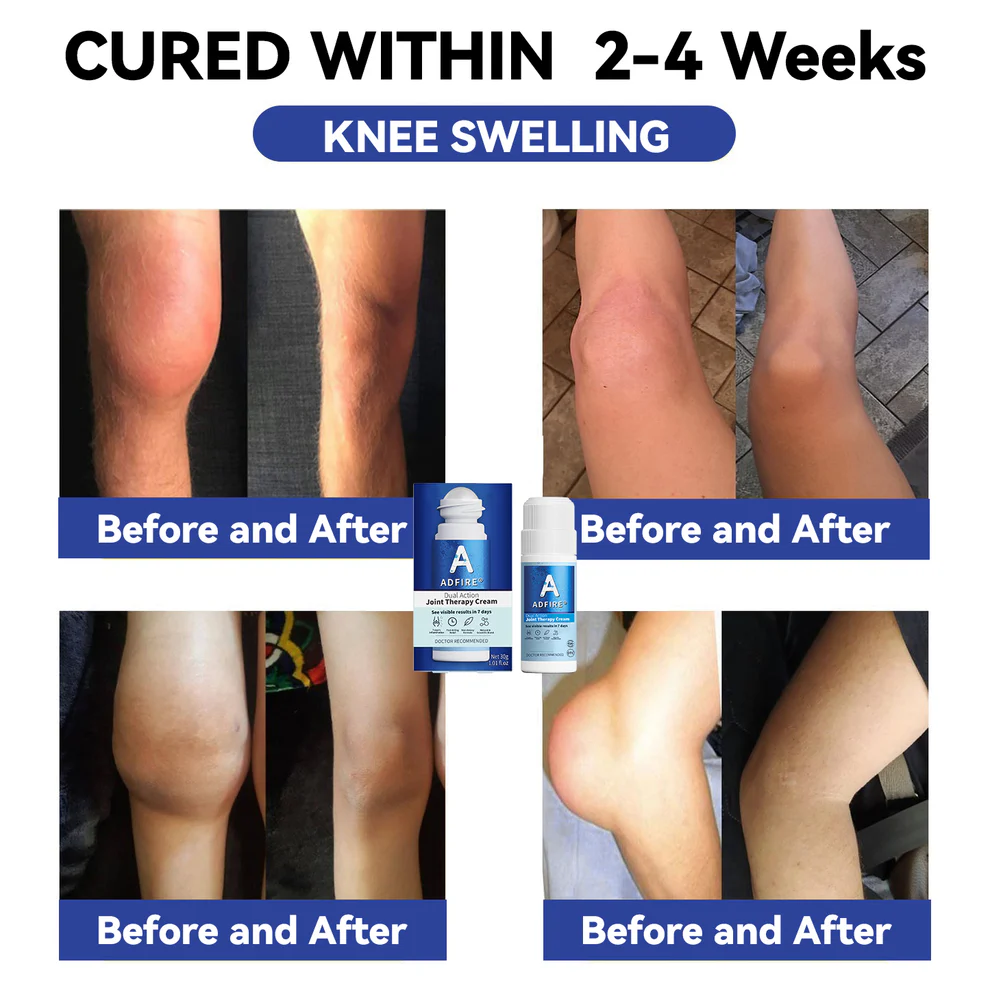 ADFIRE® Dual Action Joint Therapy Cream 12 ADFIRE® Dual Action Joint Therapy Cream