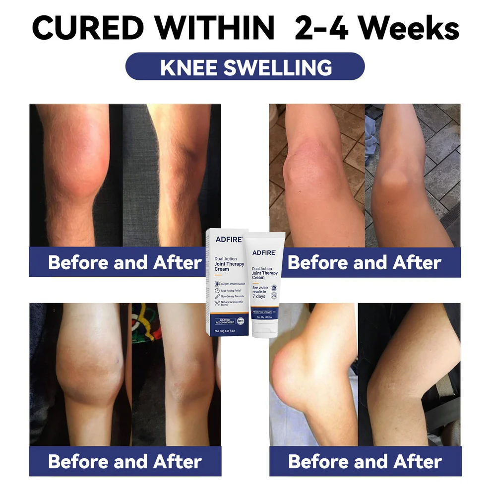 ADFIRE® Dual Action Pain Relief 10 ADFIRE® Dual Action Pain Relief