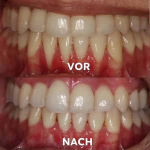 Seurico™ Gum Repair & Oral Health Powder