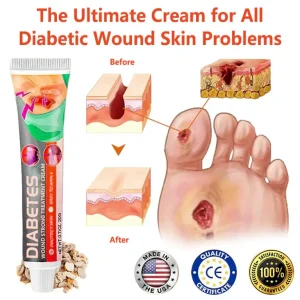 QIAWI™ Natural Products, Diabetes Wound Strong Treatment Cream 11 QIAWI™ Natural Products, Diabetes Wound Strong Treatment Cream