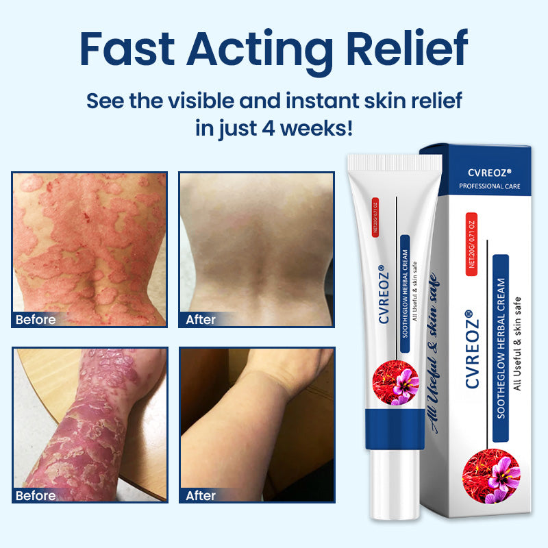 CVREOZ® SootheGlow Herbal Cream 6 CVREOZ® SootheGlow Herbal Cream