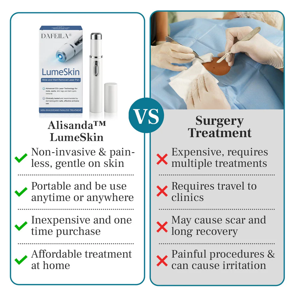 Alisanda™ LumeSkin Mole and Wart Removal Laser Pen