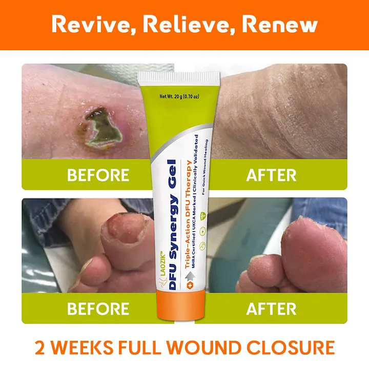 LAOZIK™ DFU Synergy Gel 11 LAOZIK™ DFU Synergy Gel