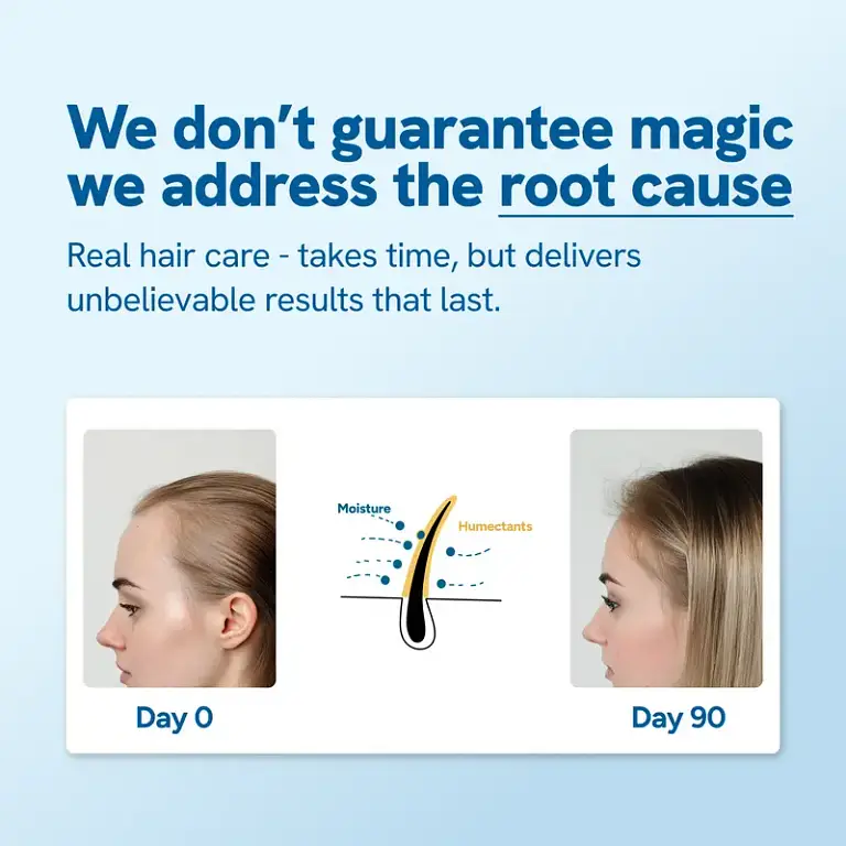 Hair Growth Roll-On Serum – See hair growth in 4 weeks 4 Hair Growth Roll-On Serum – See hair growth in 4 weeks