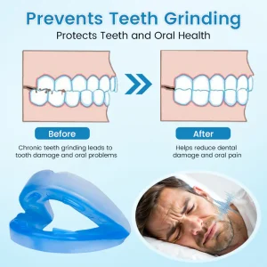 QIAWI™ DreamGuard: Anti-Snoring & Teeth Grinding Mouthpiece 17 QIAWI™ DreamGuard: Anti-Snoring & Teeth Grinding Mouthpiece