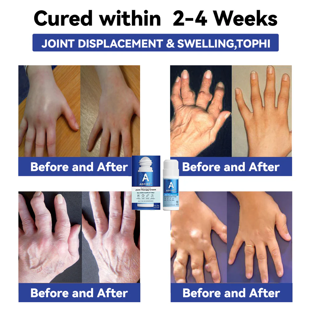 ADFIRE® Dual Action Joint Therapy Cream 11 ADFIRE® Dual Action Joint Therapy Cream