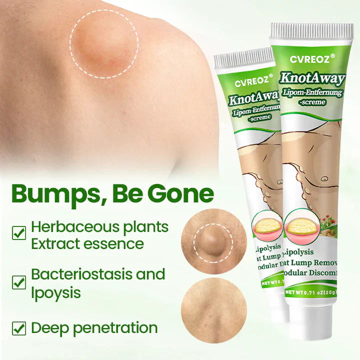 Cvreoz® KnotAway Lipoma Removal Cream 7 Cvreoz® KnotAway Lipoma Removal Cream