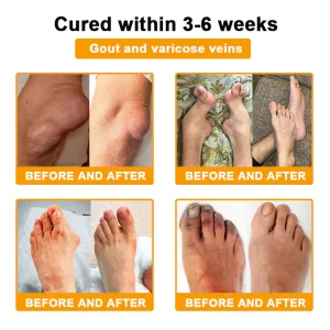 Raindew® Botulinum Toxin & Bee Venom Pain-Relief Bone Healing Cream 25 Raindew® Botulinum Toxin & Bee Venom Pain-Relief Bone Healing Cream