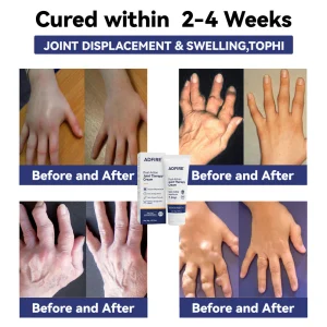 ADFIRE® Dual Action Pain Relief 20 ADFIRE® Dual Action Pain Relief