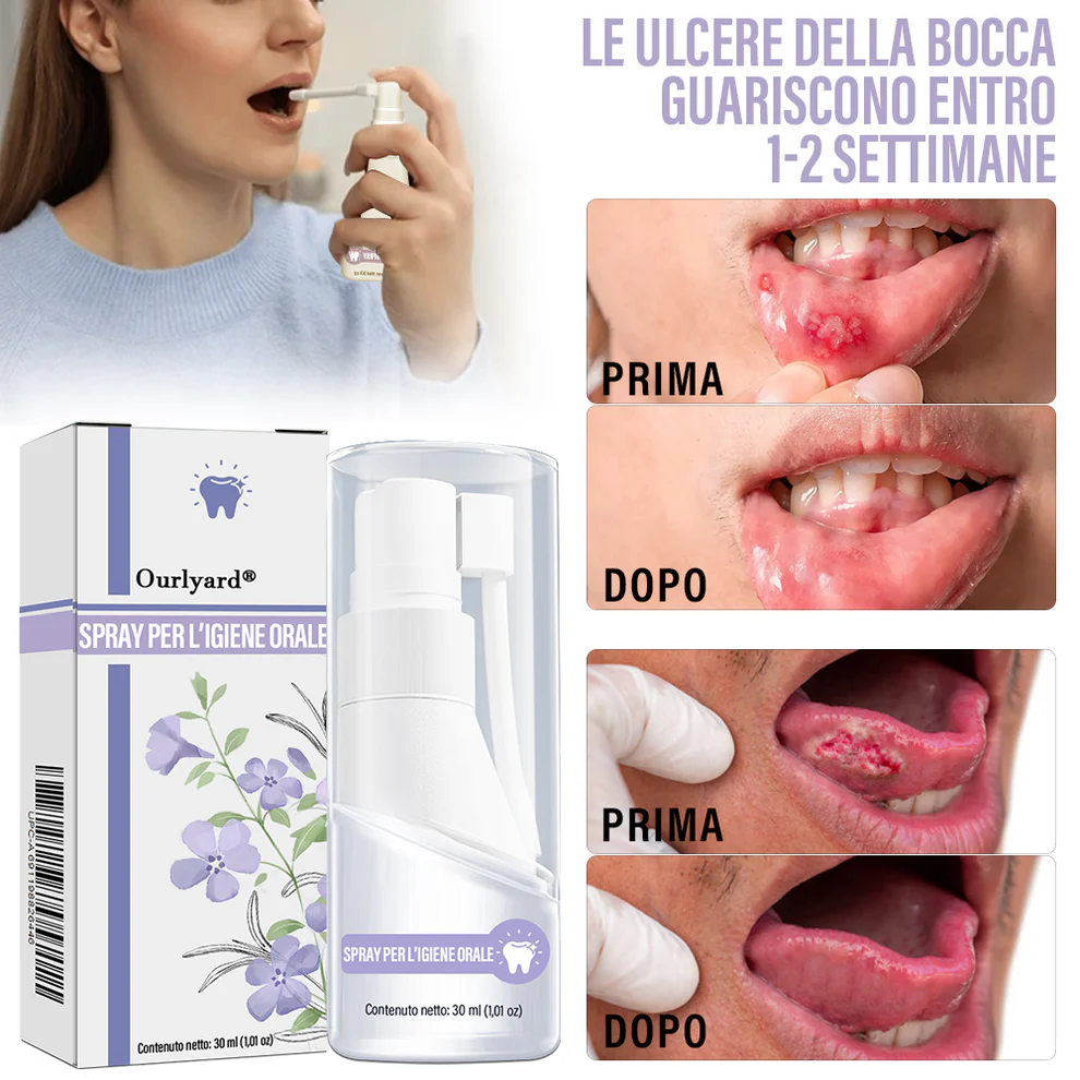 Ourlyard® Oral Care Spray with Clove Oil 4 Ourlyard® Oral Care Spray with Clove Oil