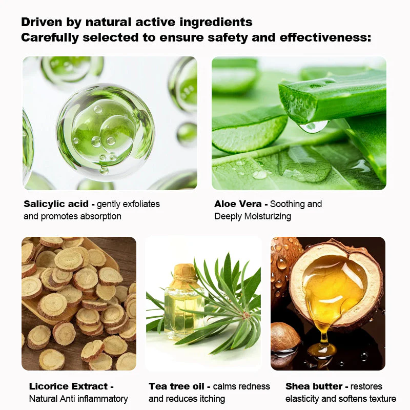 NESLEMY™ Psoriasis Cure Cream 10 NESLEMY™ Psoriasis Cure Cream