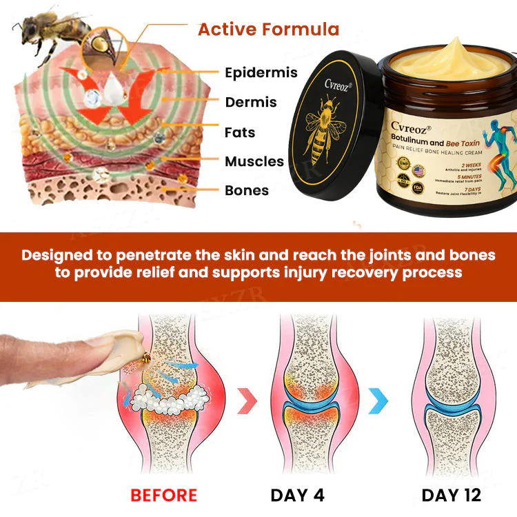 Cvreoz® Botulinum and Bee Toxin Pain Relief Bone Healing Cream 5 Cvreoz® Botulinum and Bee Toxin Pain Relief Bone Healing Cream