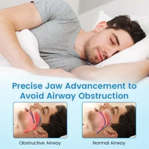 JEREMYTIS™ Adjustable Anti-Snoring Mouthpiece 19 JEREMYTIS™ Adjustable Anti-Snoring Mouthpiece