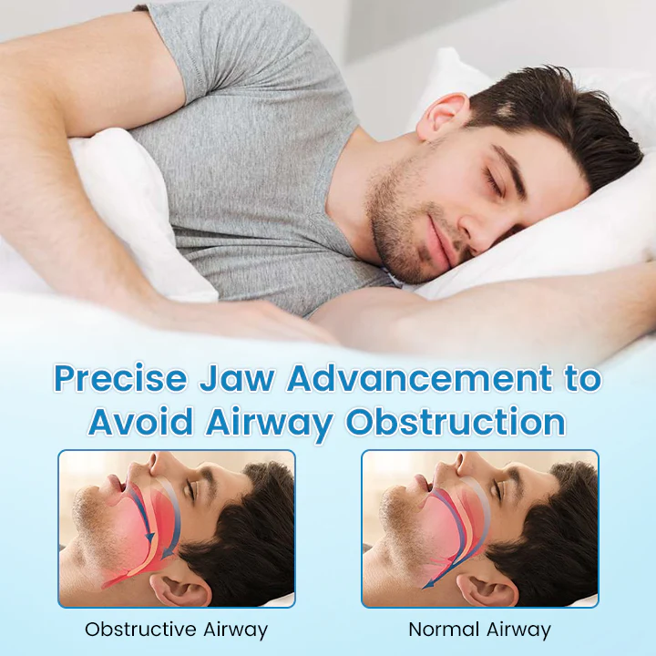 QIAWI™ DreamGuard: Anti-Snoring & Teeth Grinding Mouthpiece 7 QIAWI™ DreamGuard: Anti-Snoring & Teeth Grinding Mouthpiece