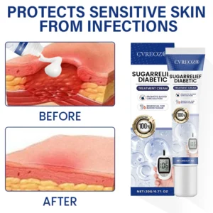 Cvreoz® SugarRelief Diabetic Treatment Cream 9 Cvreoz® SugarRelief Diabetic Treatment Cream