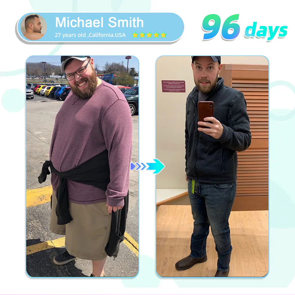 ADFIRE® NIDDK-Tirzepatide Slimming & health NANO MICRONEEDLE PATCH 7 ADFIRE® NIDDK-Tirzepatide Slimming & health NANO MICRONEEDLE PATCH