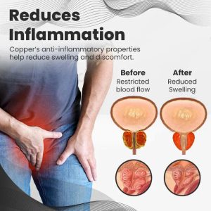 Histone™ Copper Mag Prostate Therapy Ring 20 Histone™ Copper Mag Prostate Therapy Ring