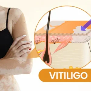 Newyuo® VitiCalm Bee Venom Cream 14 Newyuo® VitiCalm Bee Venom Cream