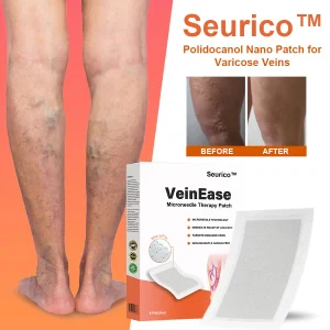 Seurico™ VeinEase Mikronadel-Therapie- Aufnaher 10 Seurico™ VeinEase Mikronadel-Therapie- Aufnaher