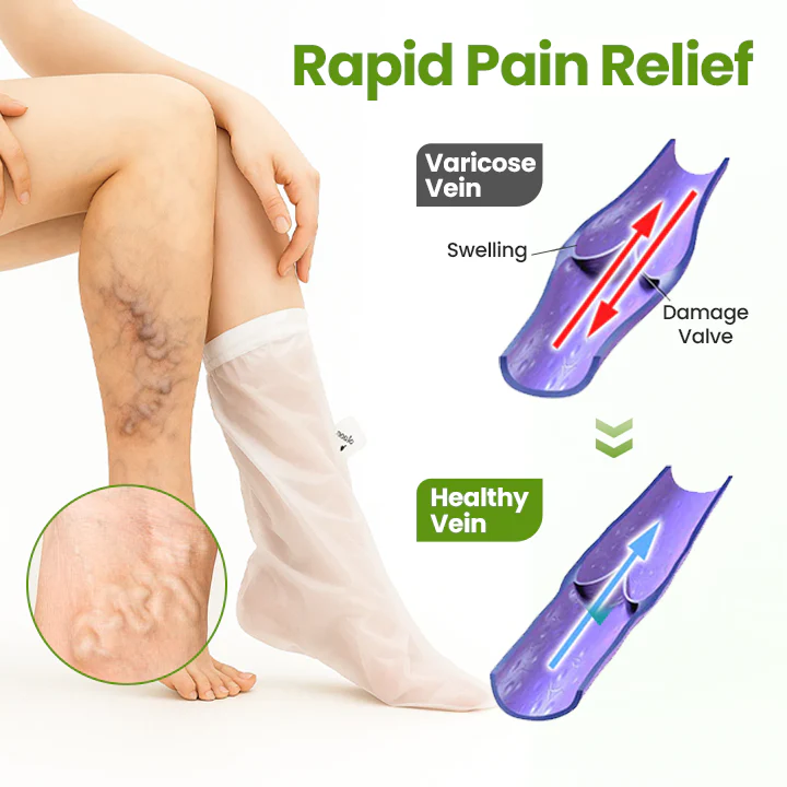 Timilk®VeinEase Leg Mask 7 Timilk®VeinEase Leg Mask