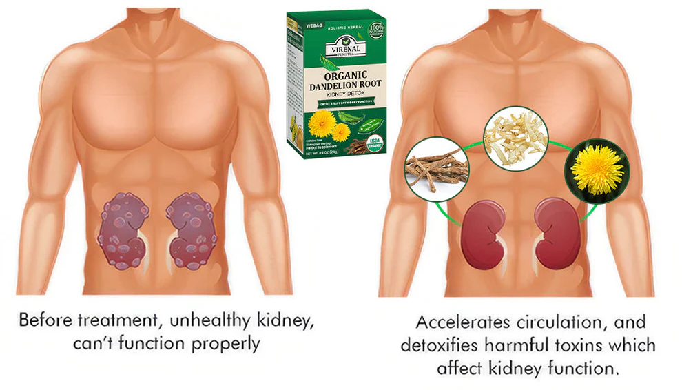 VIRENAL WEBAG™ Organic Dandelion Root Kidney Detox 2 VIRENAL WEBAG™ Organic Dandelion Root Kidney Detox