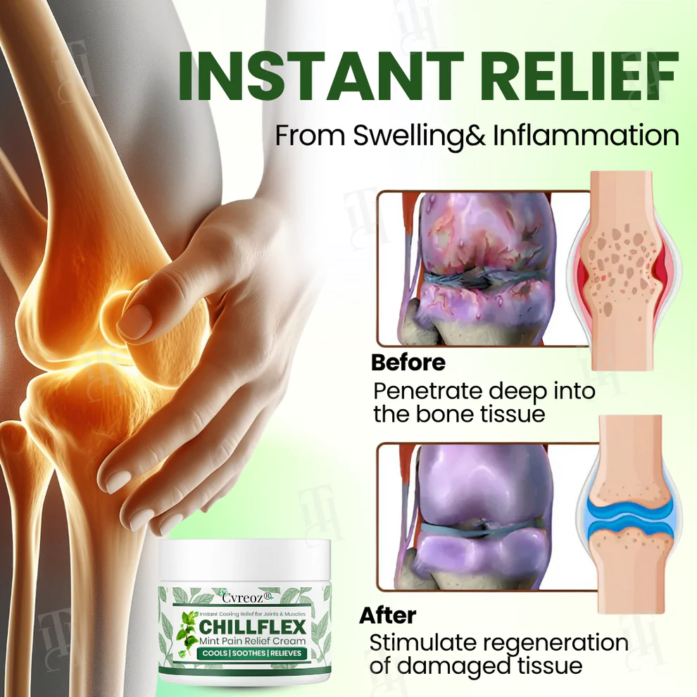 Cvreoz® Chillflex Mint Pain Relief Cream 6 Cvreoz® Chillflex Mint Pain Relief Cream