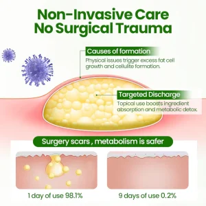 Cvreoz® DermaLump Relief Spray 23 Cvreoz® DermaLump Relief Spray