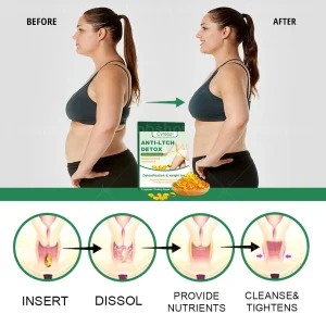 Cvreoz®Anti-ltch Detox Slimming Capsule 12 Cvreoz®Anti-ltch Detox Slimming Capsule