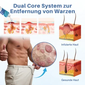 Oveallgo® GentX Wart Relief Cream 17 Oveallgo® GentX Wart Relief Cream