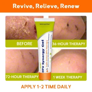 LAOZIK™ DFU Synergy Gel 23 LAOZIK™ DFU Synergy Gel