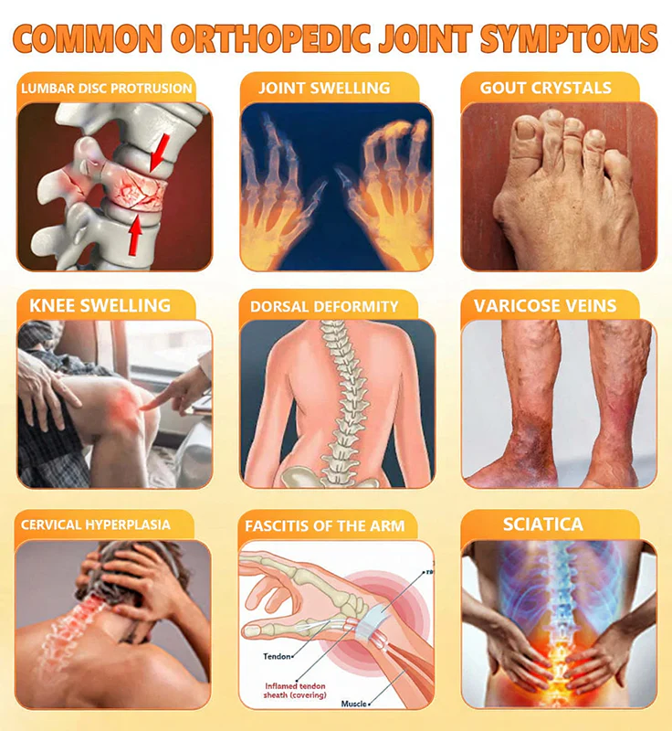 Jorondy® Bee Venom Pain-Relief Bone Healing Spray 9 Jorondy® Bee Venom Pain-Relief Bone Healing Spray