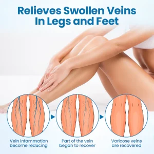 Ourlyard® VeinGuard Pain & Heaviness Microdarts Patch 20 Ourlyard® VeinGuard Pain & Heaviness Microdarts Patch