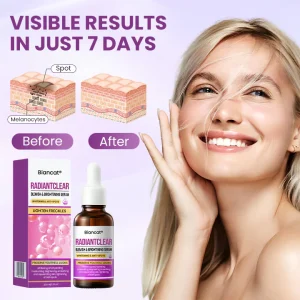 Biancat® RadiantClear Blemish & Brightening Serum 17 Biancat® RadiantClear Blemish & Brightening Serum