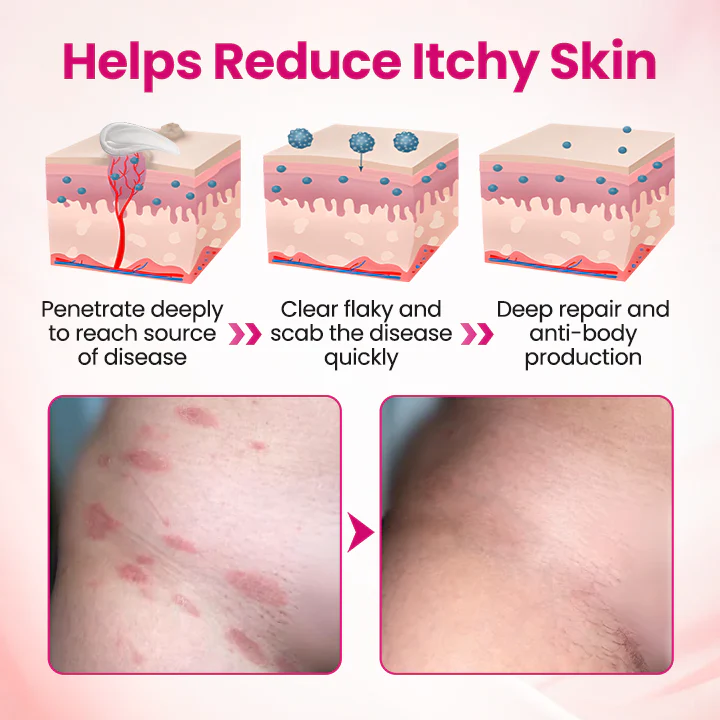 Timilk® IntiDefend Anti-HPV Interferon Gel 10 Timilk® IntiDefend Anti-HPV Interferon Gel