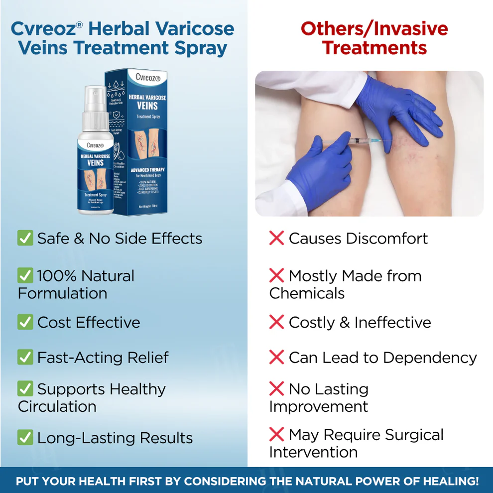 Cvreoz® Herbal Varicose Veins Treatment Spray 5 Cvreoz® Herbal Varicose Veins Treatment Spray