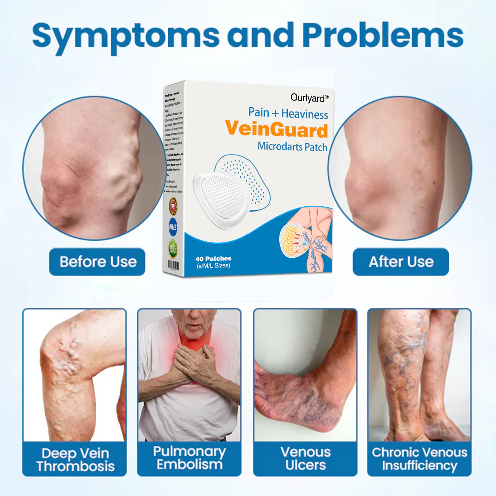 Ourlyard® VeinGuard Pain & Heaviness Microdarts Patch 7 Ourlyard® VeinGuard Pain & Heaviness Microdarts Patch