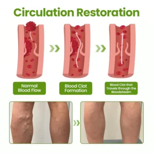 Timilk®VeinEase Leg Mask 13 Timilk®VeinEase Leg Mask