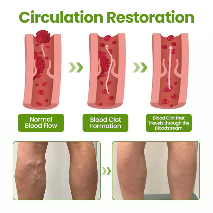 Timilk®VeinEase Leg Mask 6 Timilk®VeinEase Leg Mask