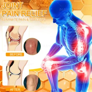 ZVLZVL® Bee Venom Pain-Relief Bone Healing Cream 16 ZVLZVL® Bee Venom Pain-Relief Bone Healing Cream