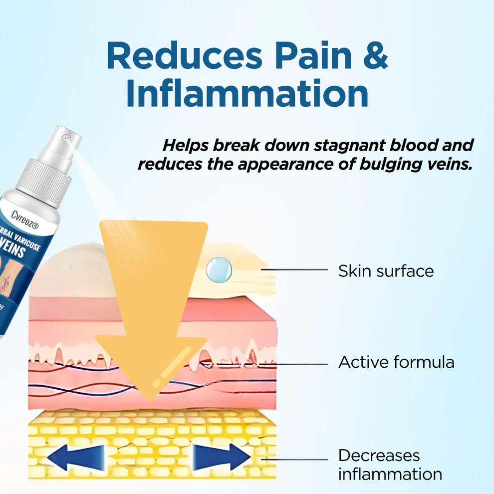 Cvreoz® Herbal Varicose Veins Treatment Spray 4 Cvreoz® Herbal Varicose Veins Treatment Spray