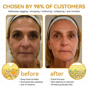 LOVILDS™ Bee Essence Skin Antibacterial Cream 15 LOVILDS™ Bee Essence Skin Antibacterial Cream