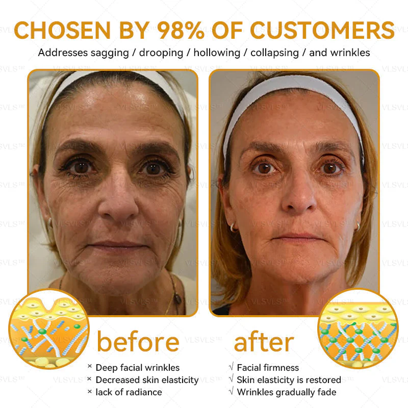 LOVILDS™ Bee Essence Skin Antibacterial Cream 6 LOVILDS™ Bee Essence Skin Antibacterial Cream