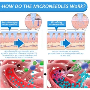 Croaie® NIDDK-Tirzepatide & Matrixyl 3000 Nano Microneedle Patch 20 Croaie® NIDDK-Tirzepatide & Matrixyl 3000 Nano Microneedle Patch