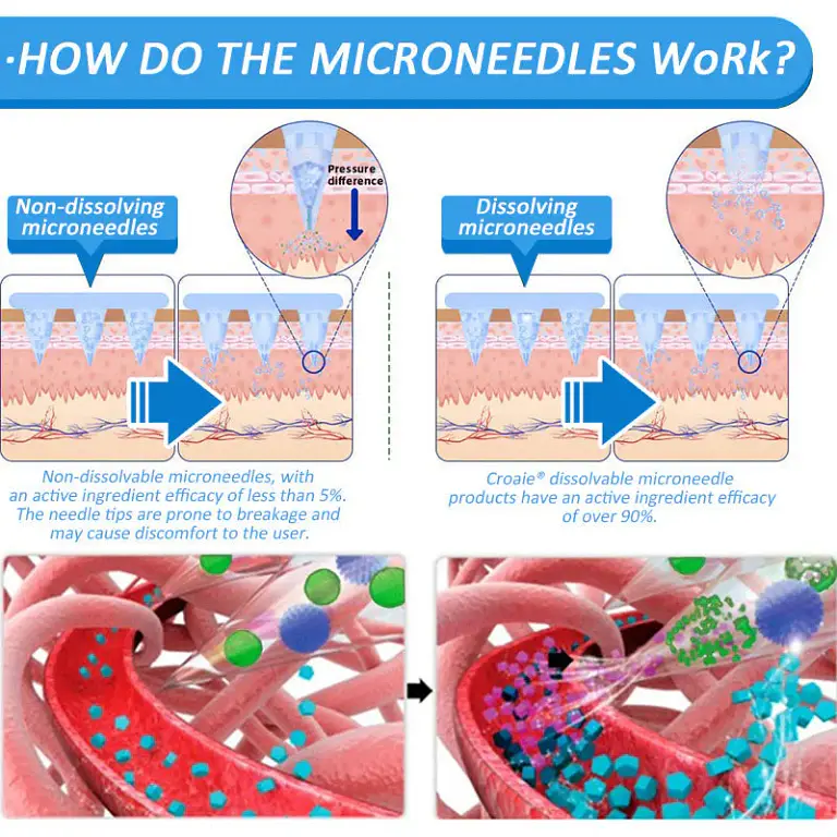 Croaie® NIDDK-Tirzepatide & Matrixyl 3000 Nano Microneedle Patch 8 Croaie® NIDDK-Tirzepatide & Matrixyl 3000 Nano Microneedle Patch