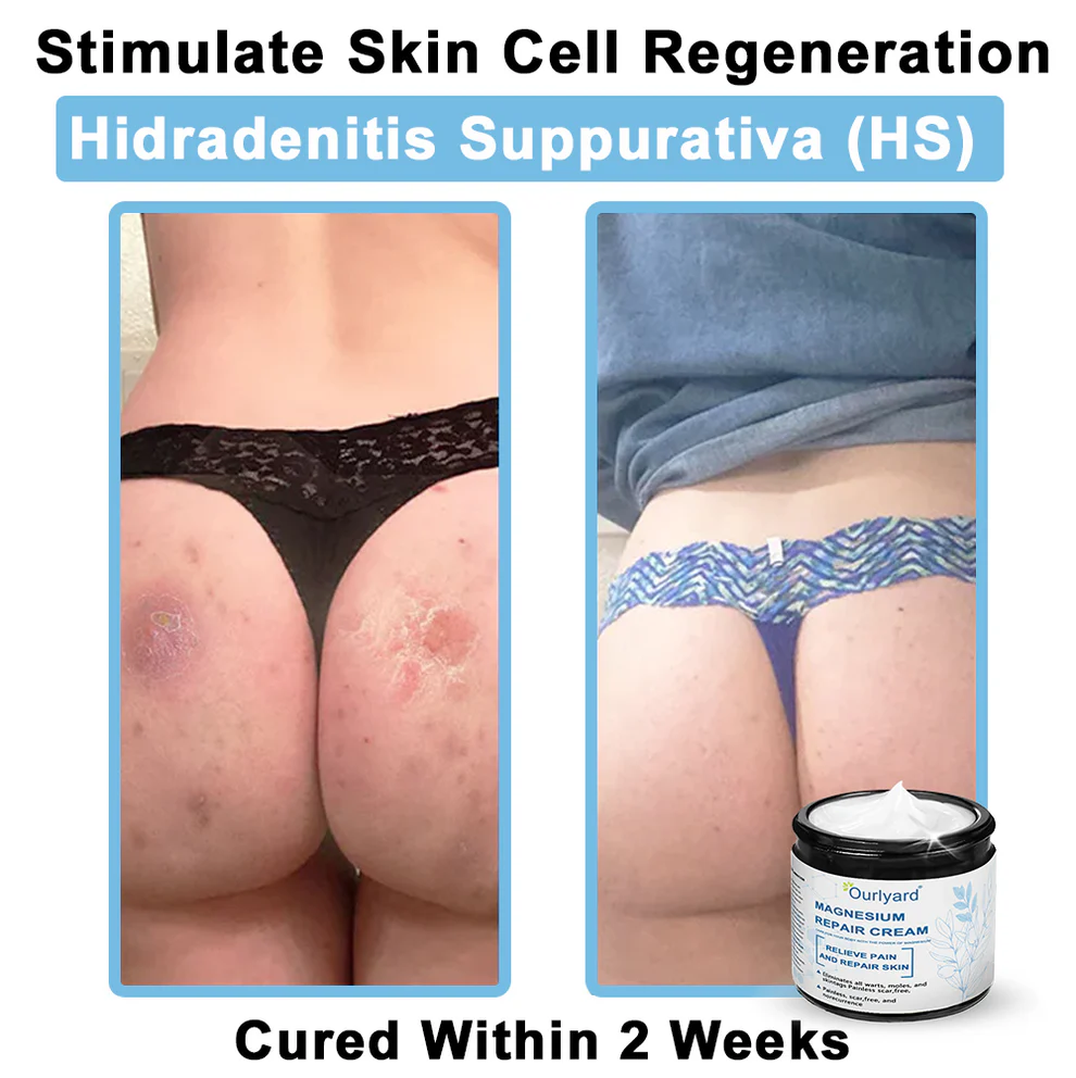 Ourlyard® Magnesium skin repair cream 6 Ourlyard® Magnesium skin repair cream