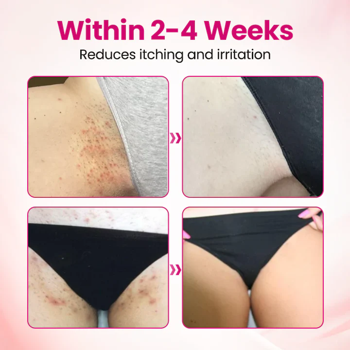 Timilk® IntiDefend Anti-HPV Interferon Gel 9 Timilk® IntiDefend Anti-HPV Interferon Gel