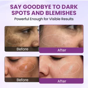 Biancat® RadiantClear Blemish & Brightening Serum 16 Biancat® RadiantClear Blemish & Brightening Serum